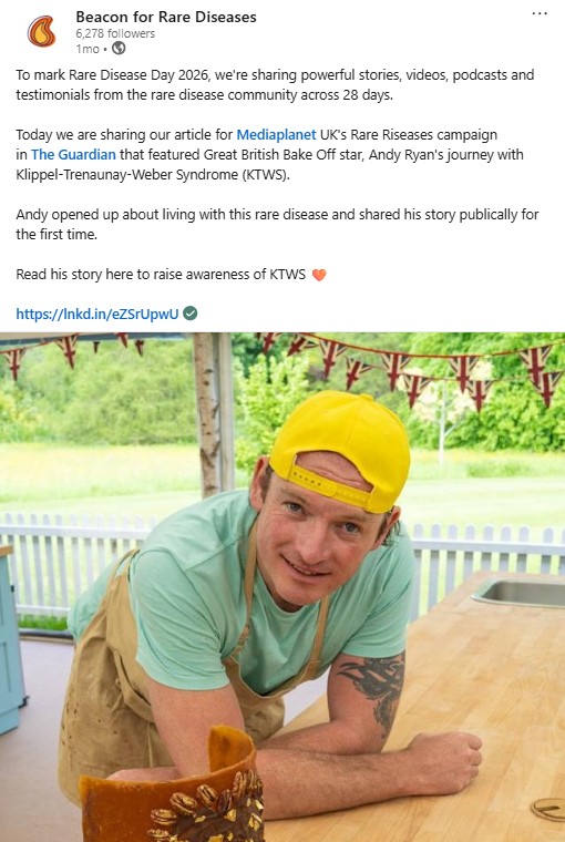 A screenshot of a Beacon LinkedIn post. The text highlights a Beacon article highlighting Andy Ryan's journey with Klippel-Trenaunay-Weber Syndrome